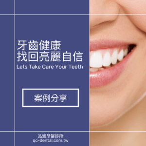 全瓷牙案例分享 牙齒美白案例分享 舒眠治療案例分享