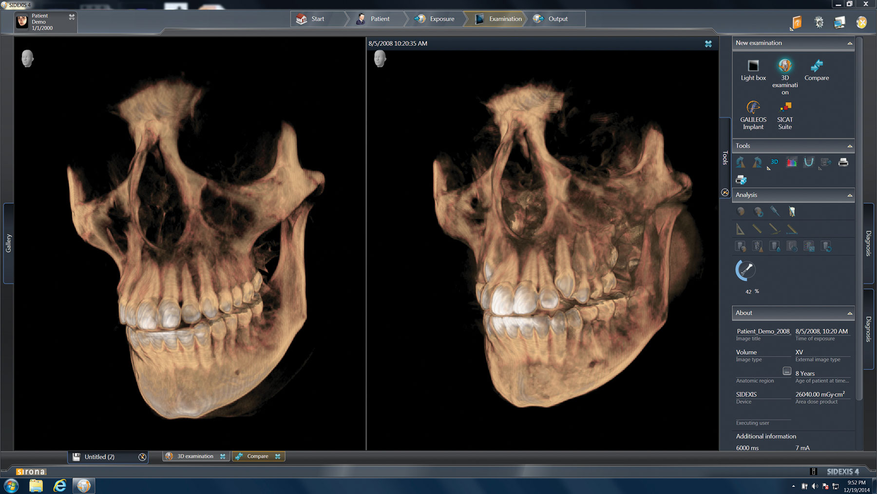 高雄牙醫推薦【3D全口數位電腦斷層掃描機】