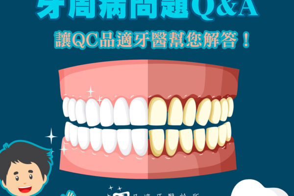 牙周病問題FQA為您解答常見疑問