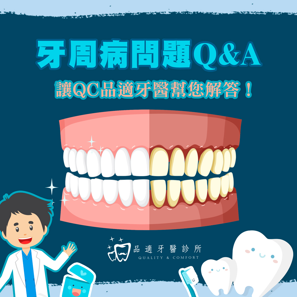 牙周病問題FQA為您解答常見疑問