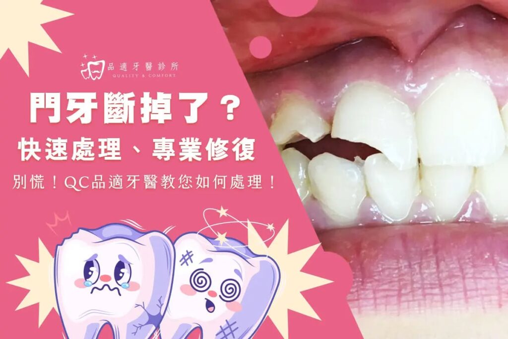 牙齒斷裂神救援 牙齒斷掉了怎麼辦?