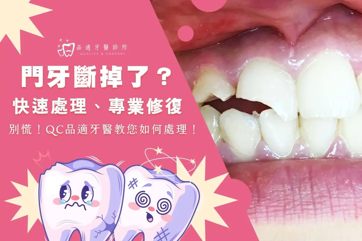 牙齒斷裂神救援 牙齒斷掉了怎麼辦?
