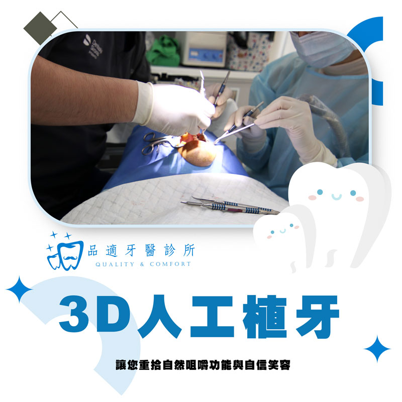3D人工植牙重建技術介紹