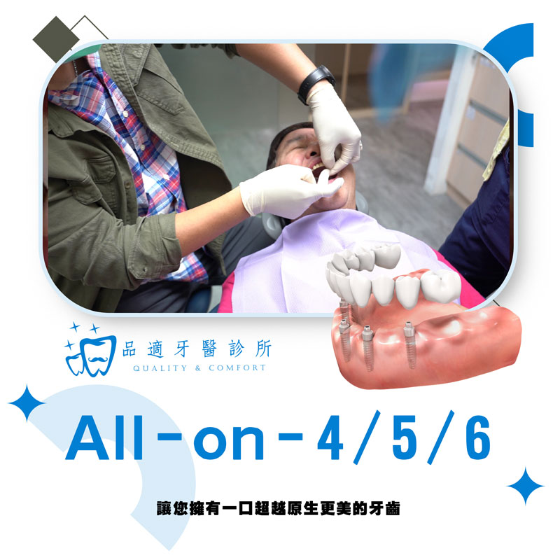 All-on-4 / 5 / 6 全口植牙重建介紹